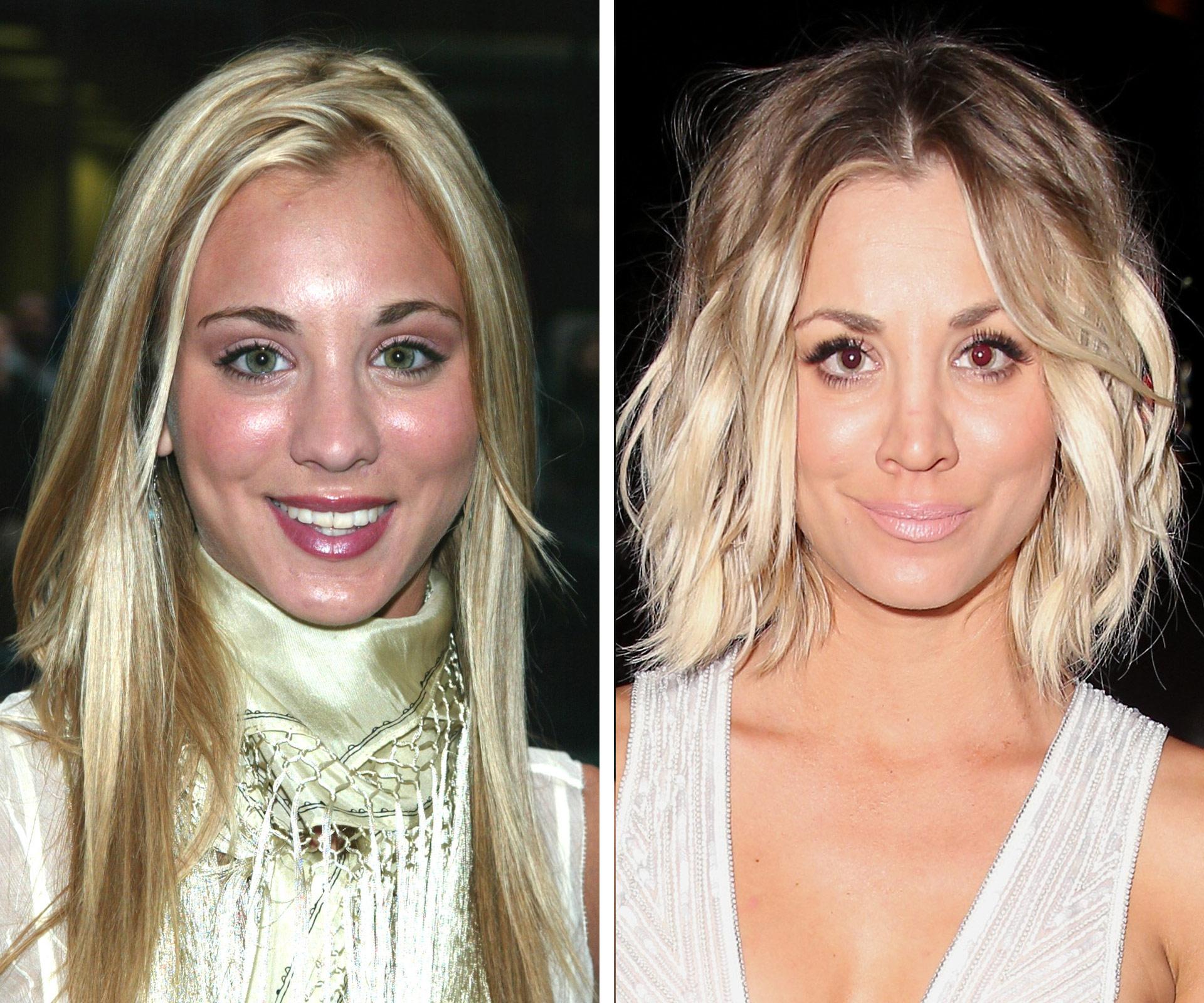 Kaley Cuoco: Plastic surgery best thing I've ever done