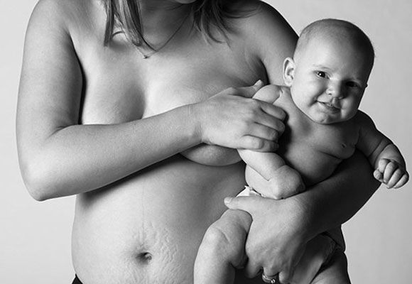 Real mums show off post-baby bodies