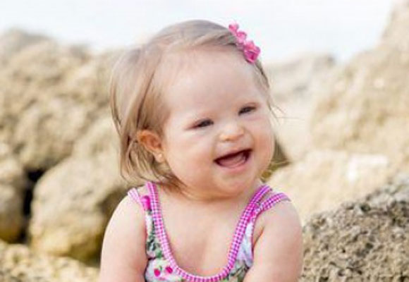 The beautiful faces of Down syndrome