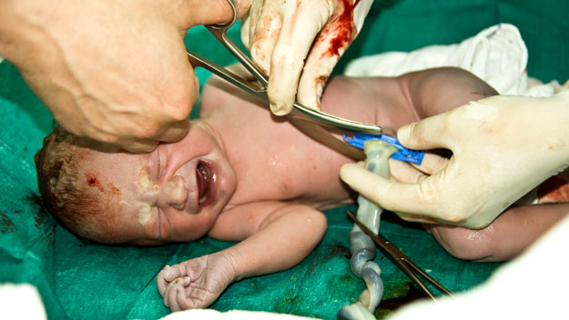Leaving umbilical cord attached latest childbirth trend