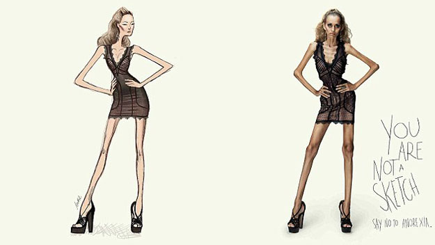 Graphic anti-anorexia campaign goes viral