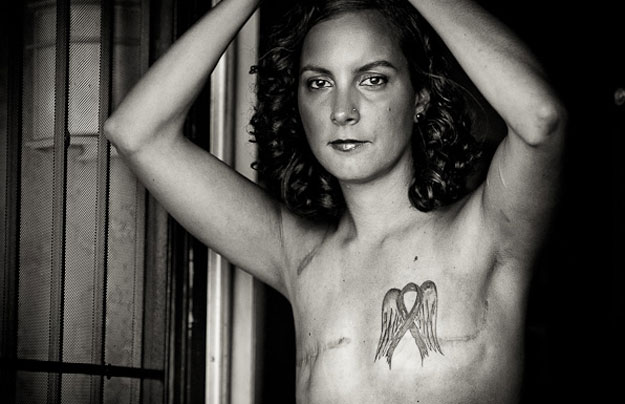 Breast cancer survivors can now share mastectomy photos on Facebook