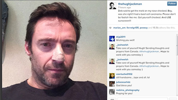 Hugh Jackman posted about his cancer on Instagram.