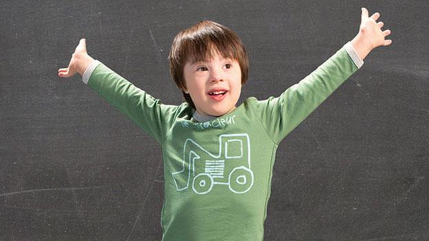 Down syndrome model