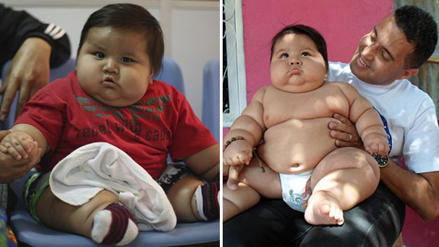 Santiago Mendoza, world's fattest baby