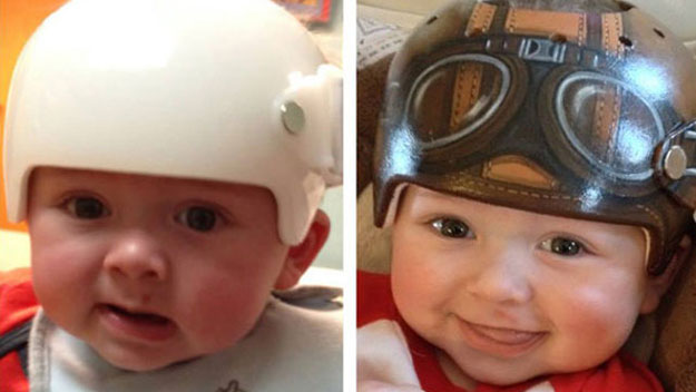 Before and after: Artist Paula Strawn paints children's medical helmets to make them look much less boring.