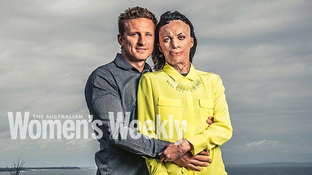Turia Pitt and her partner Michael Hoskins. Photography by Tim Bauer. Styling by Jamela Duncan.