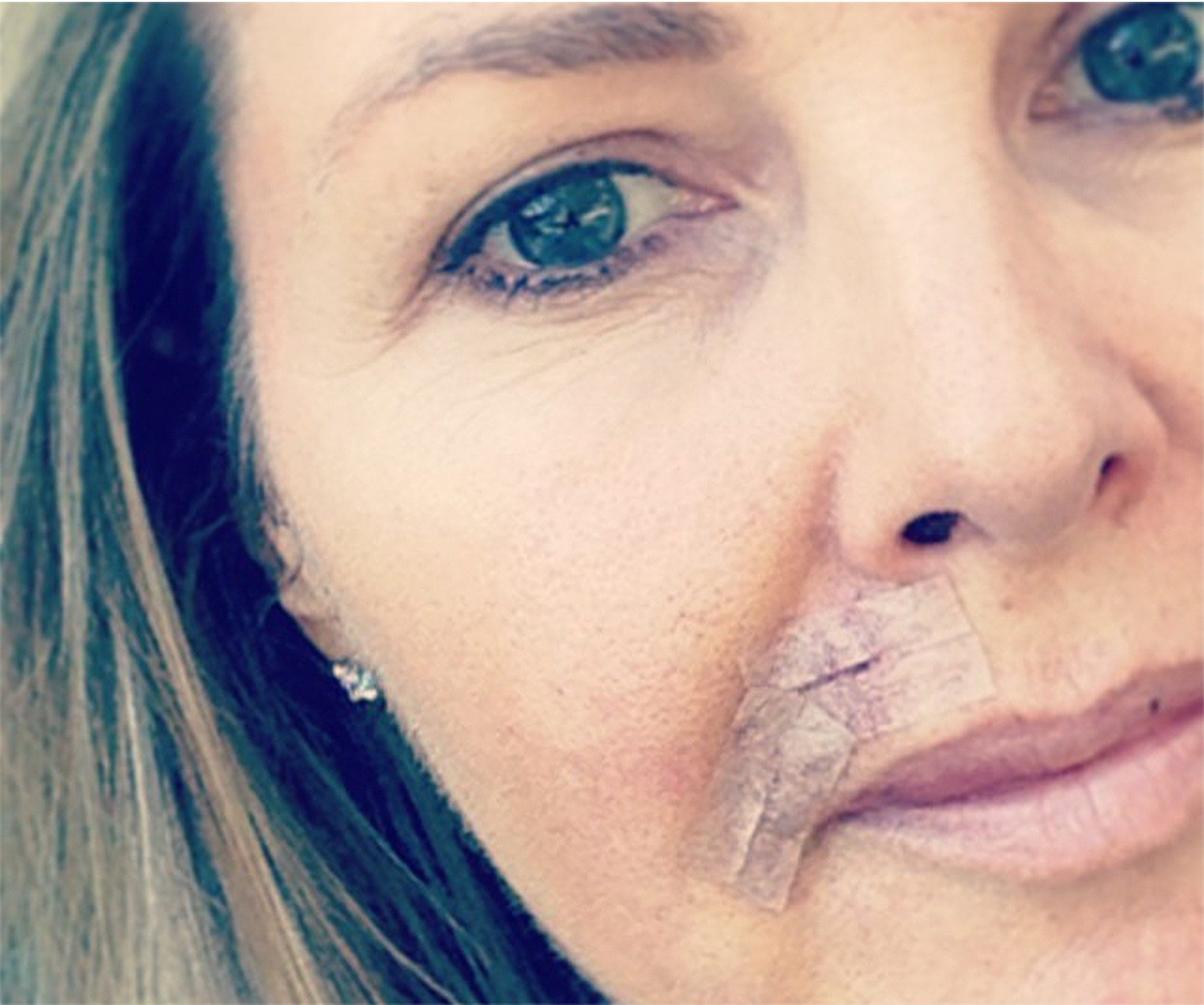 Georgie Gardner: “Please be sun smart and get your skin checked”