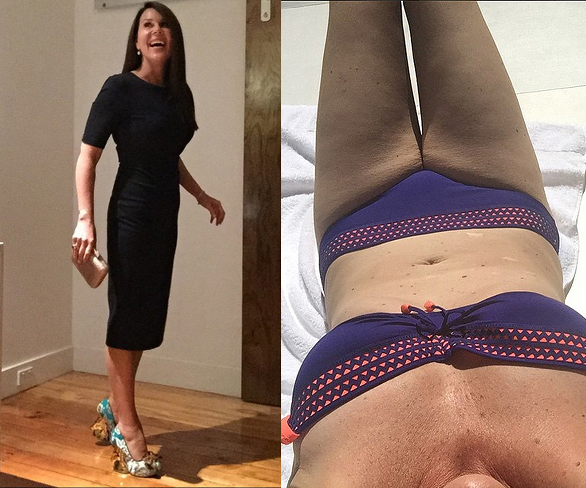 Julia Morris says weight loss is a result of hard work – not surgery