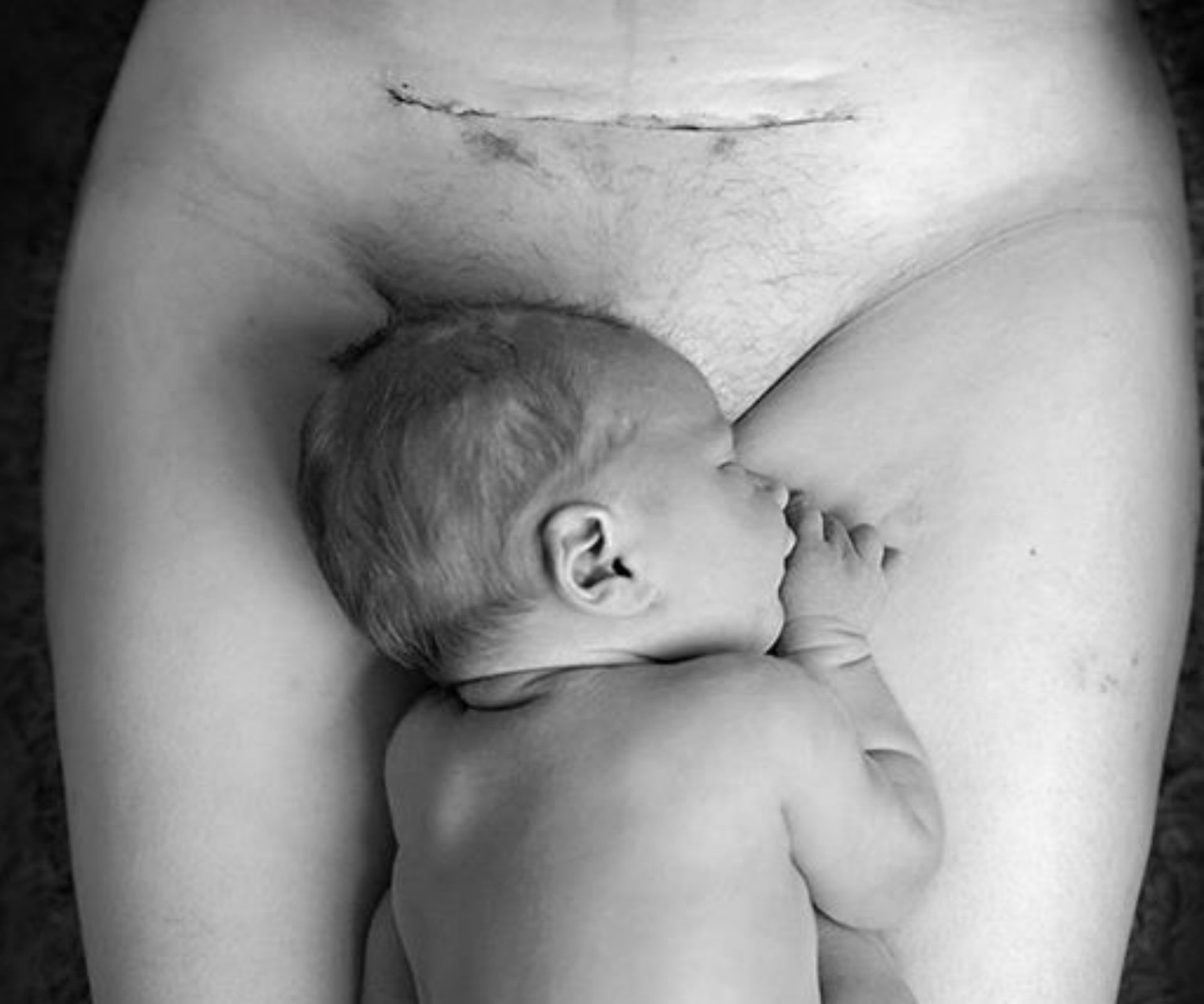 The photo changing people’s views on c-sections