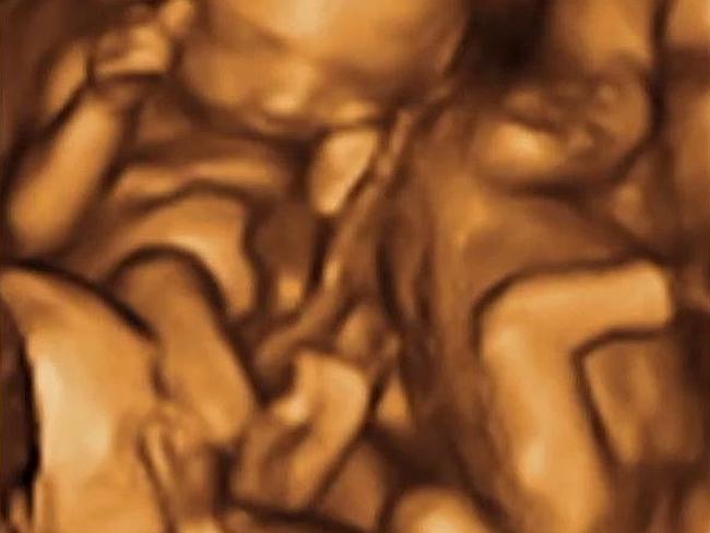 Fake ultrasound image from fakeababy.com