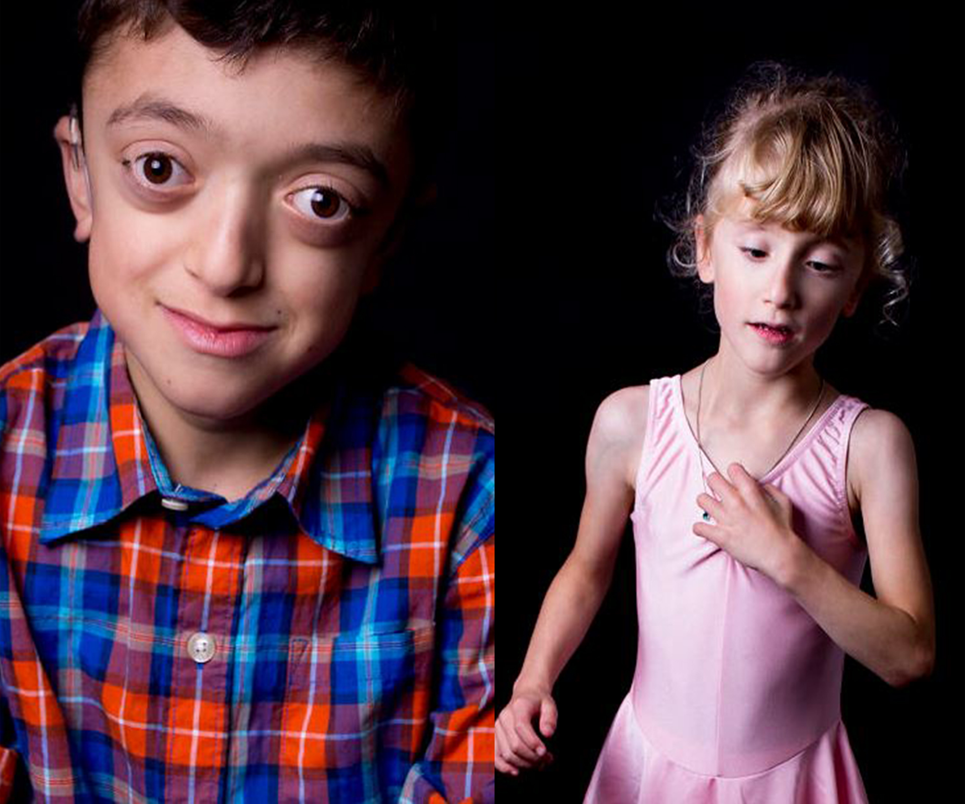 The Rare Project: woman photographs children with rare disabilities