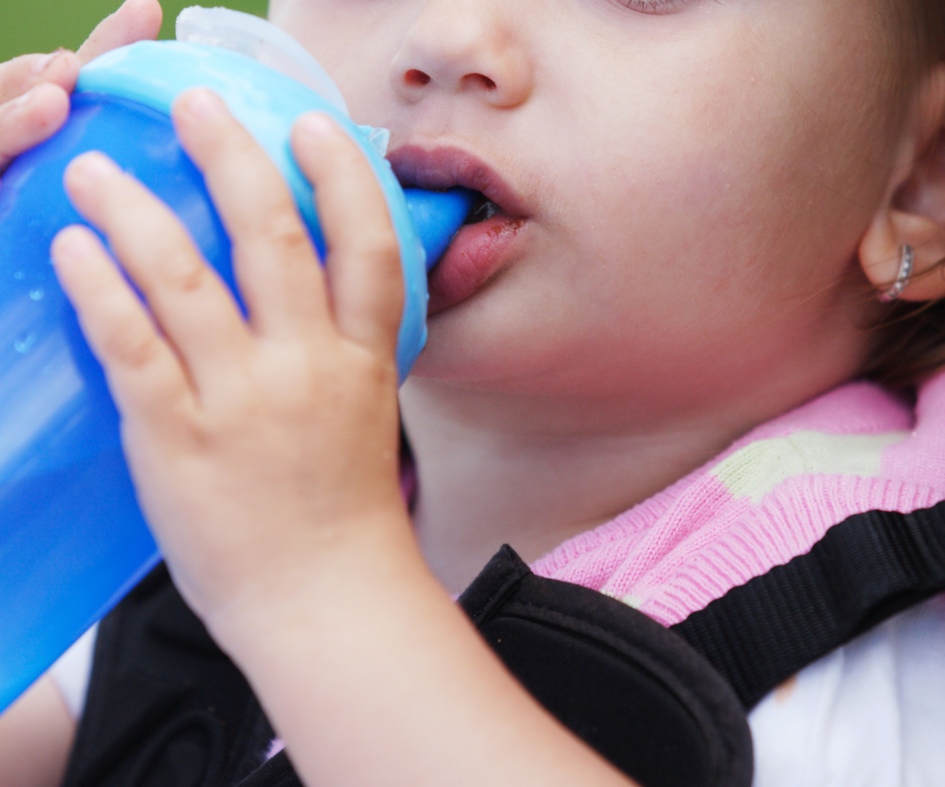 Toddler gets second degree burns from sippy cup at daycare