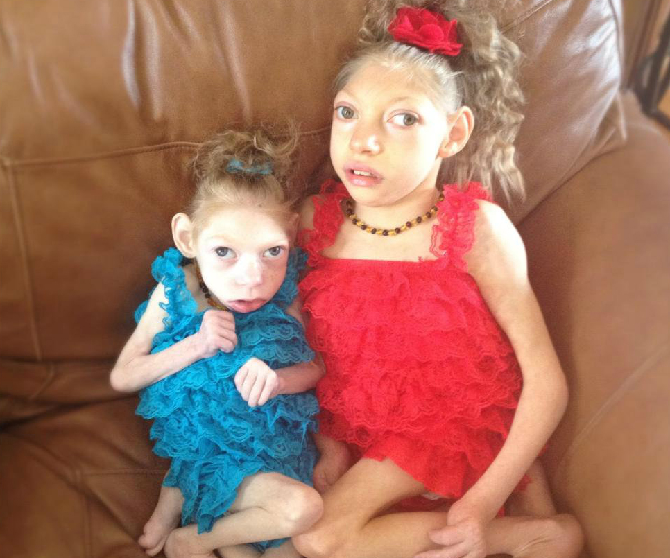 Miracle sisters battle rare genetic disorder
