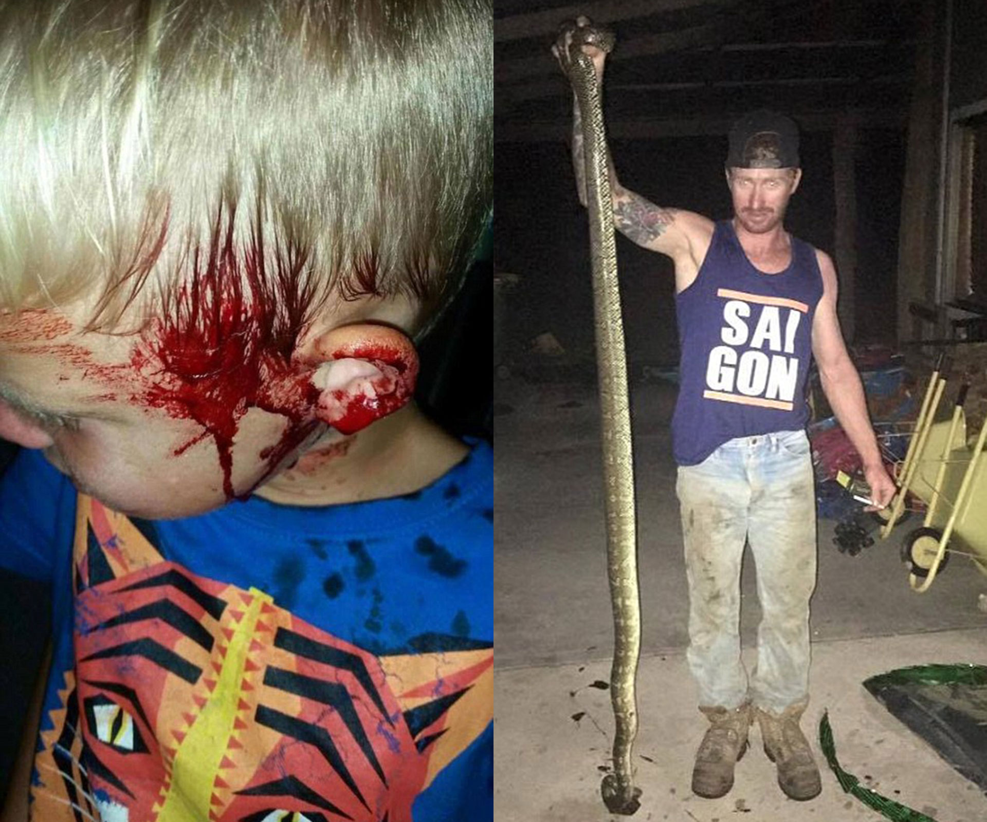 Giant snake attacks NSW boy as he sleeps