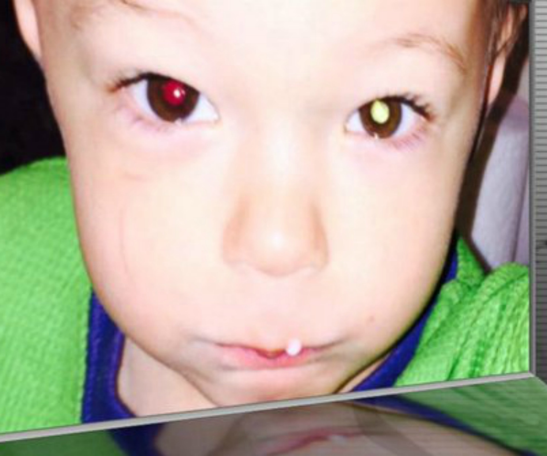Mum catches toddler’s eye cancer in photographs