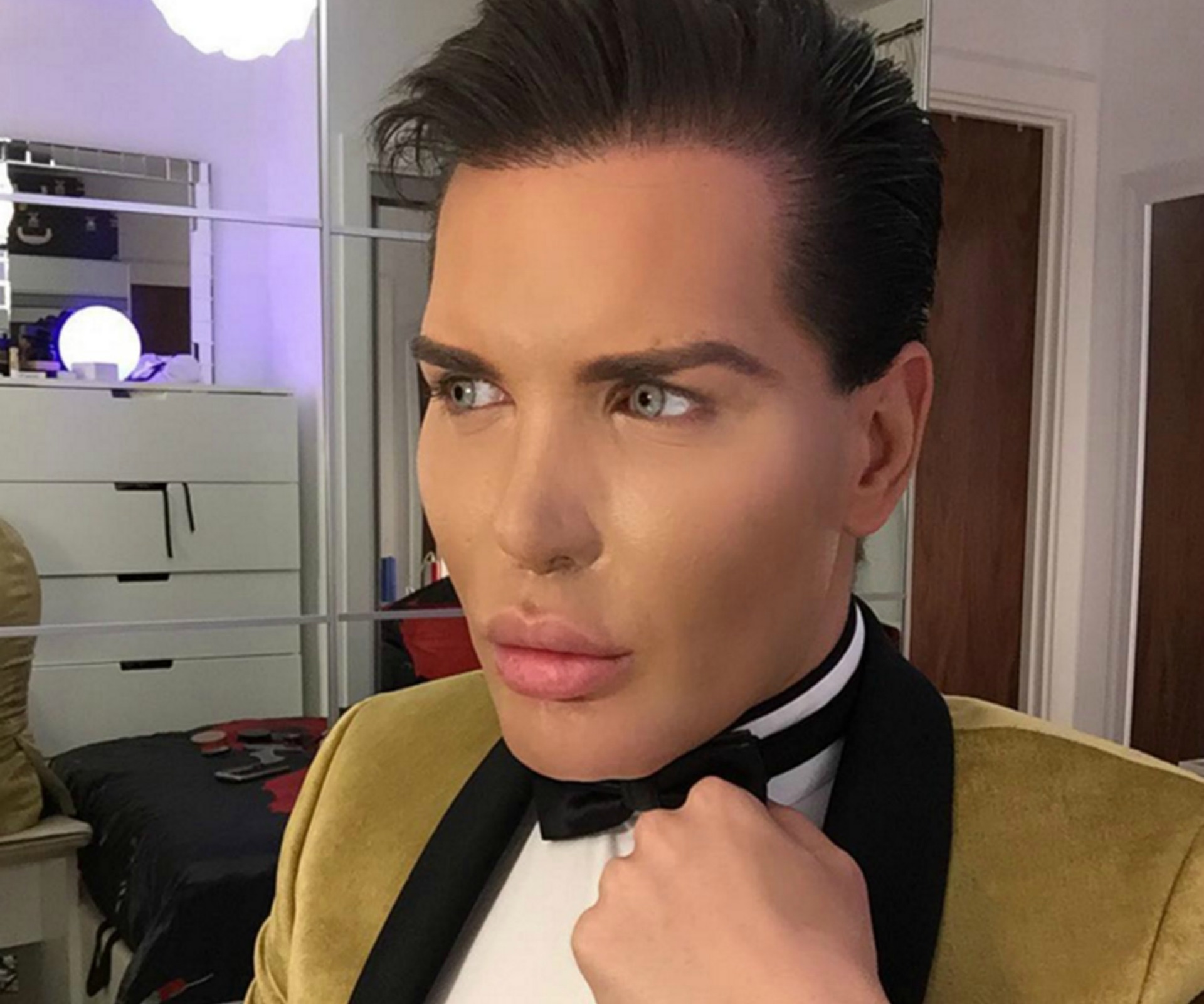 Real-life Ken doll rushed to hospital after face begins to collapse