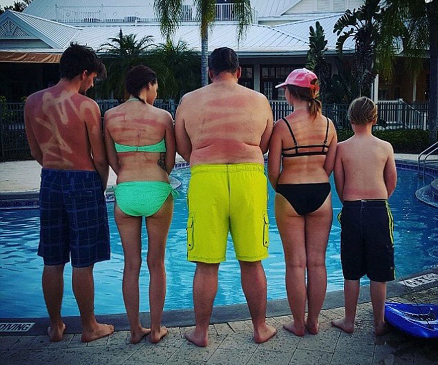 Family’s hilarious sunburn fail