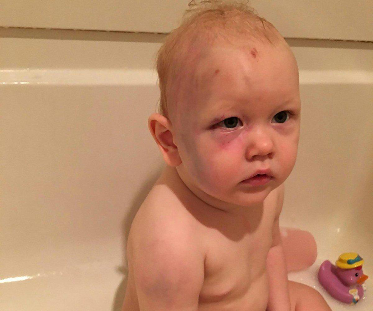 Babysitter accused of beating one-year-old toddler avoids charges