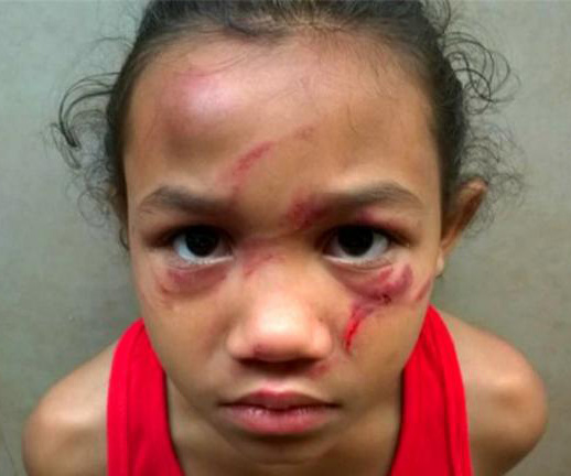 Girl bashed by 11 year old at school 
