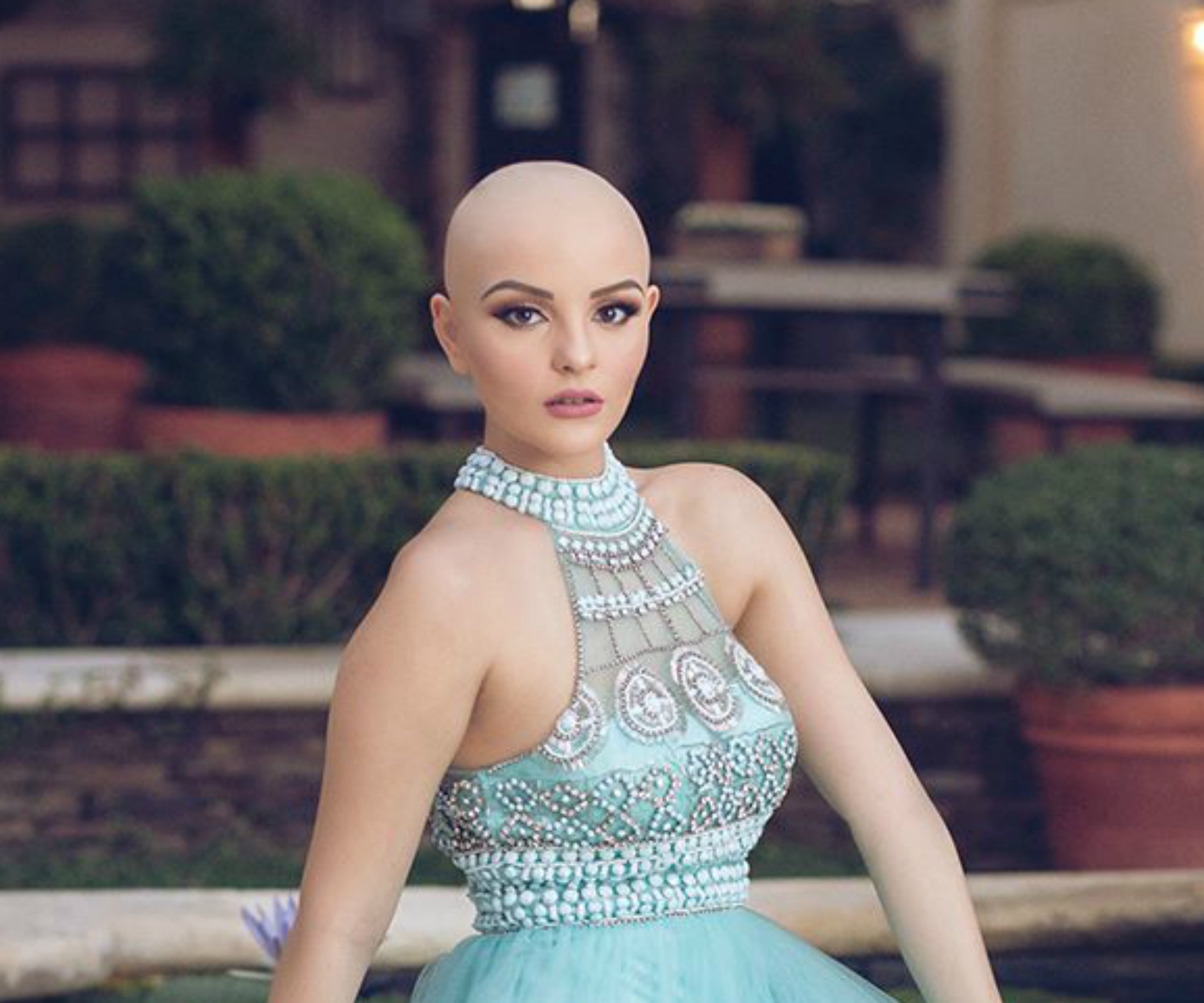 Model makes powerful statement after she lost her hair