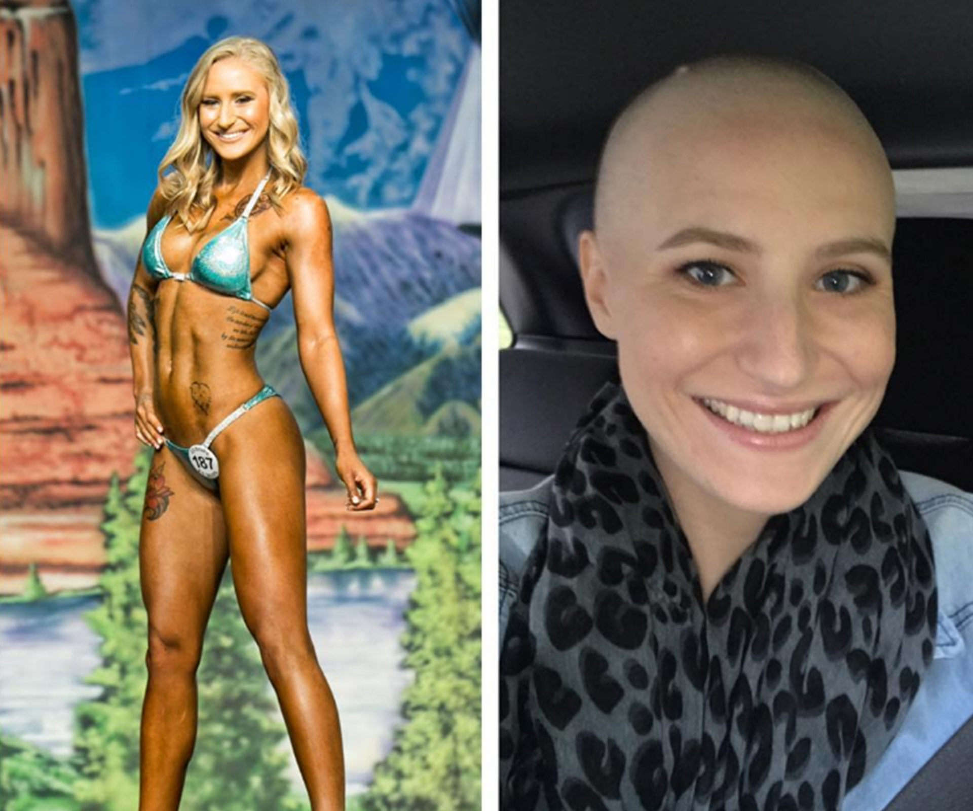 Bikini competitor on how her ovarian cancer journey has changed her body