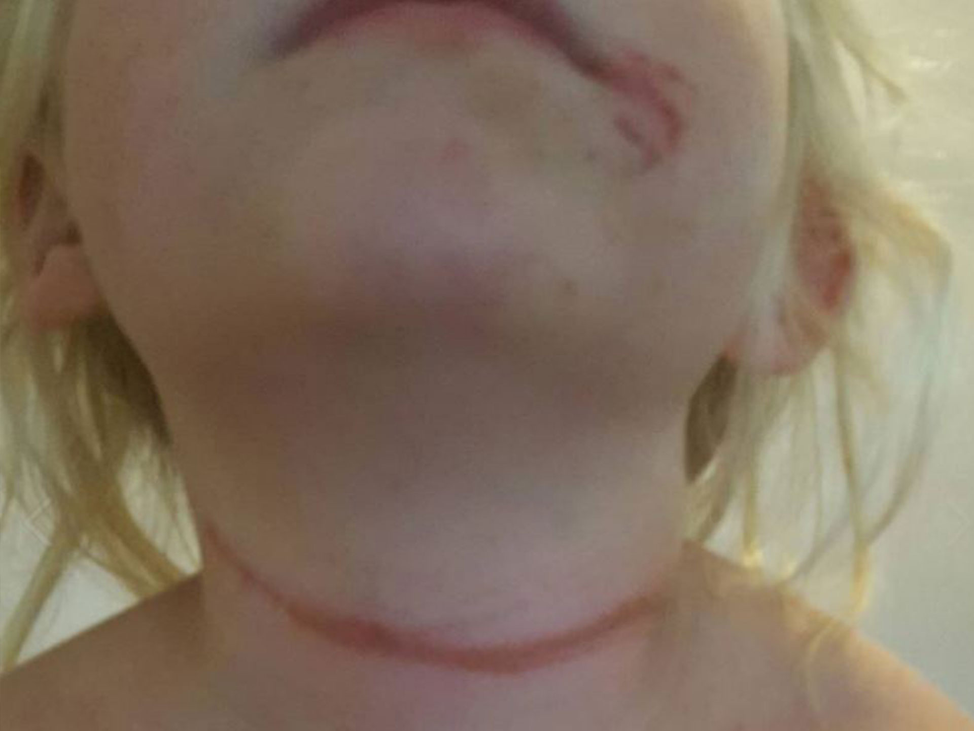 Cords on hats banned in SA schools after little girl is almost strangled