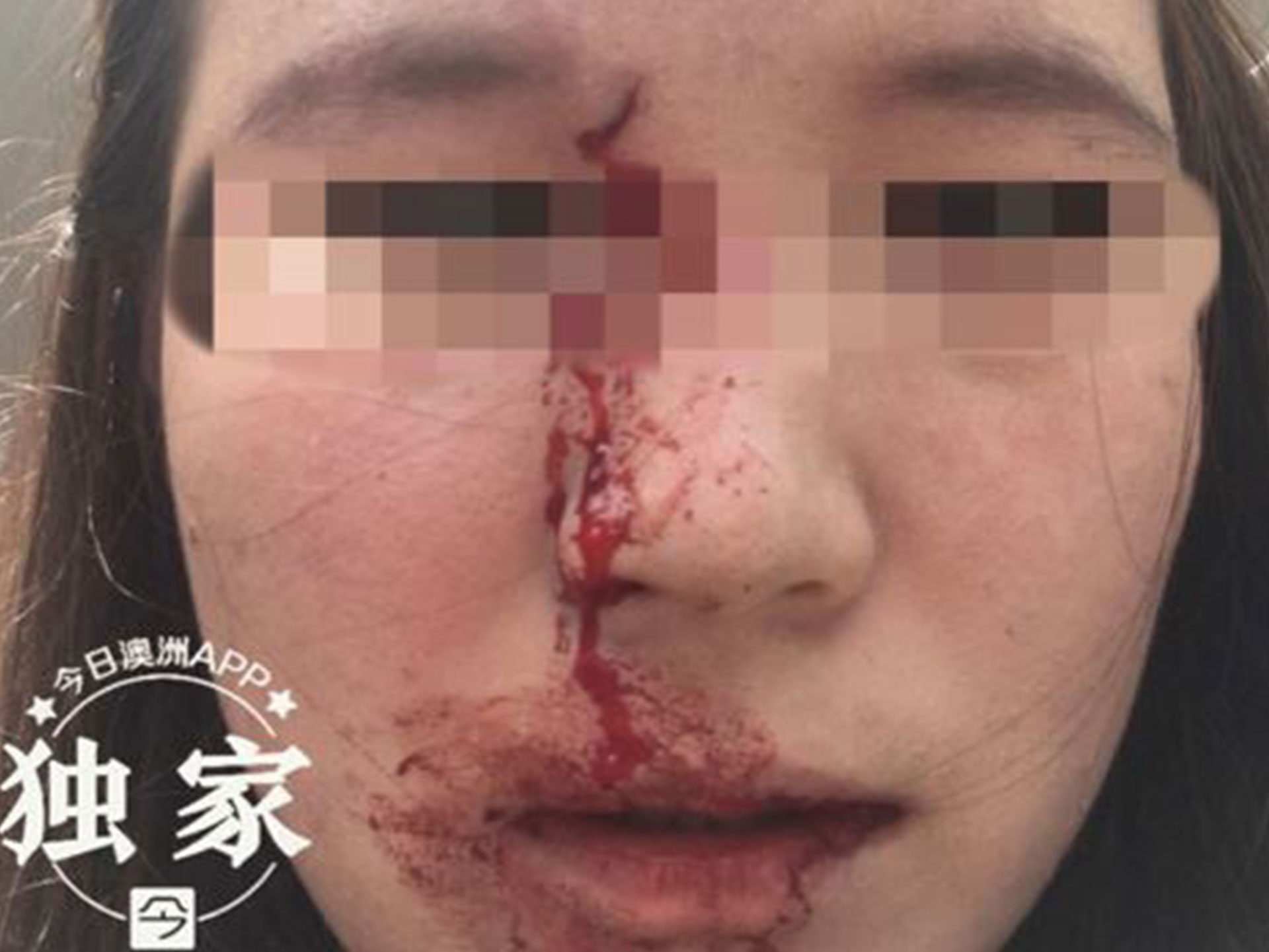 Chinese-Australian woman victim of racist attack in Sydney