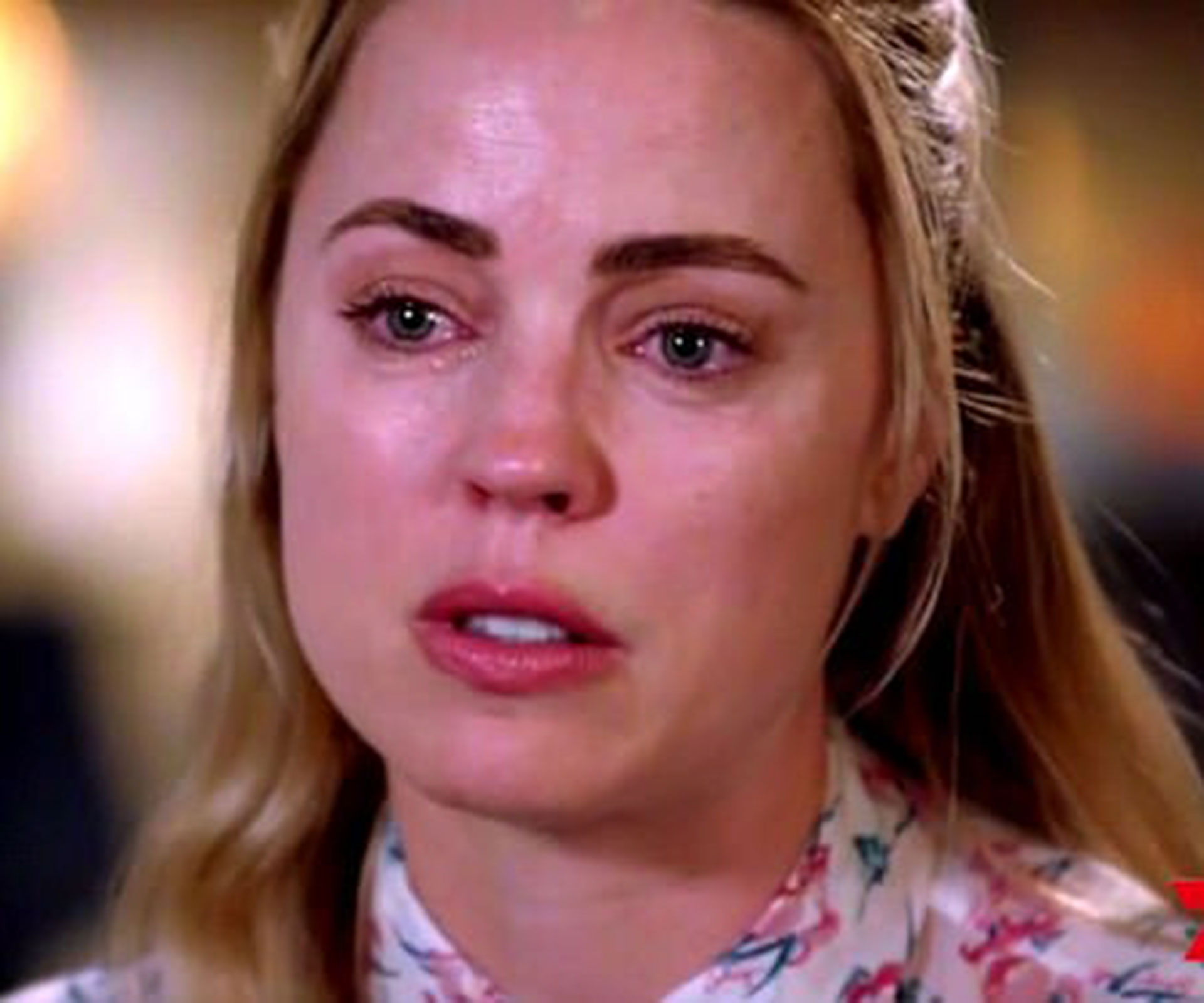 Melissa George reveals horrific injury pictures as she asks Australia for help