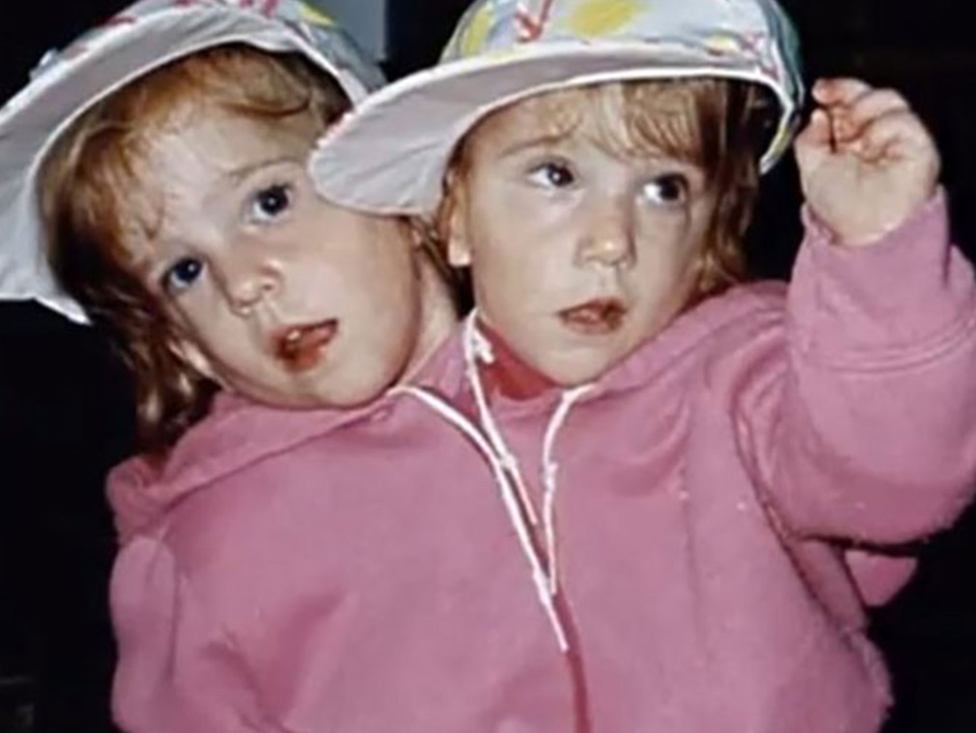 What are conjoined twins Abby and Brittany Hensel up to now?