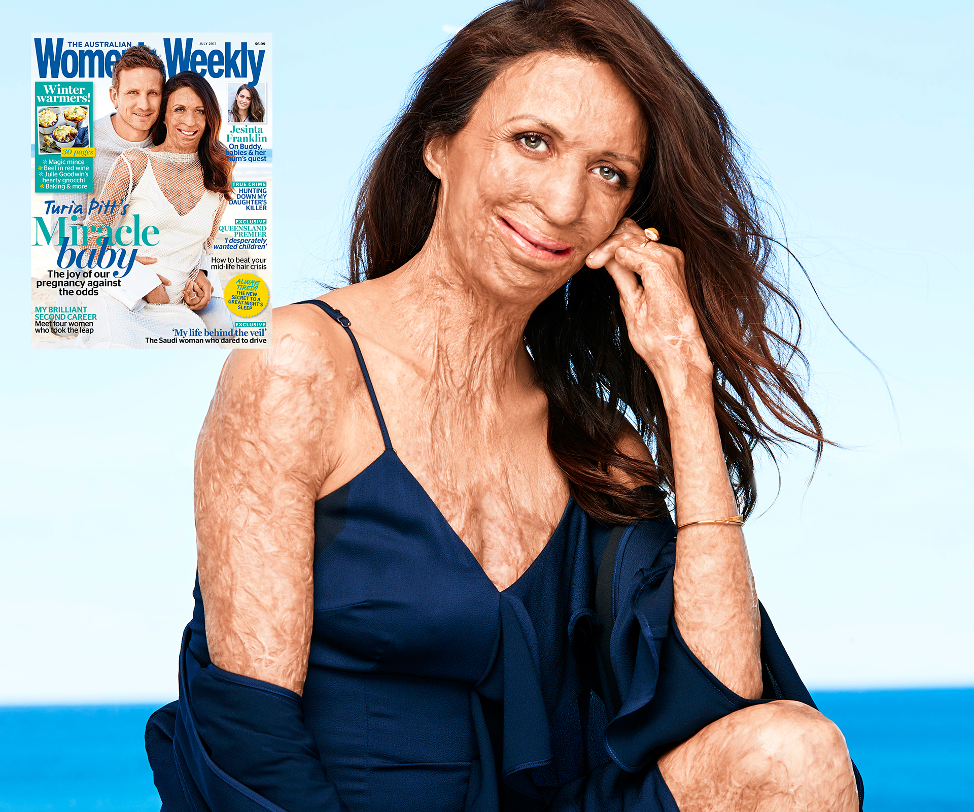 “The thought of a baby kept me going…” Touching new details behind Turia Pitt’s miracle pregnancy