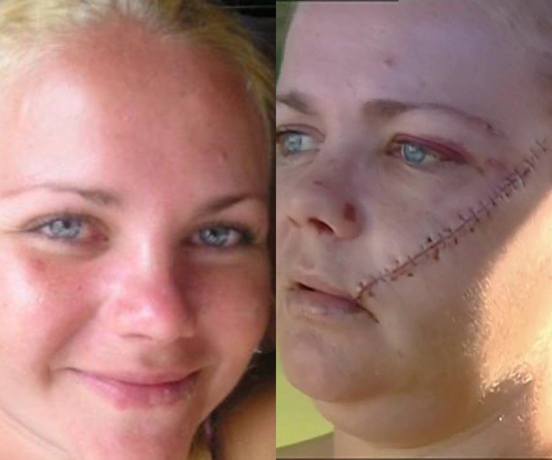 Gold Coast mum recounts horrifying machete attack that left her face “hanging off”