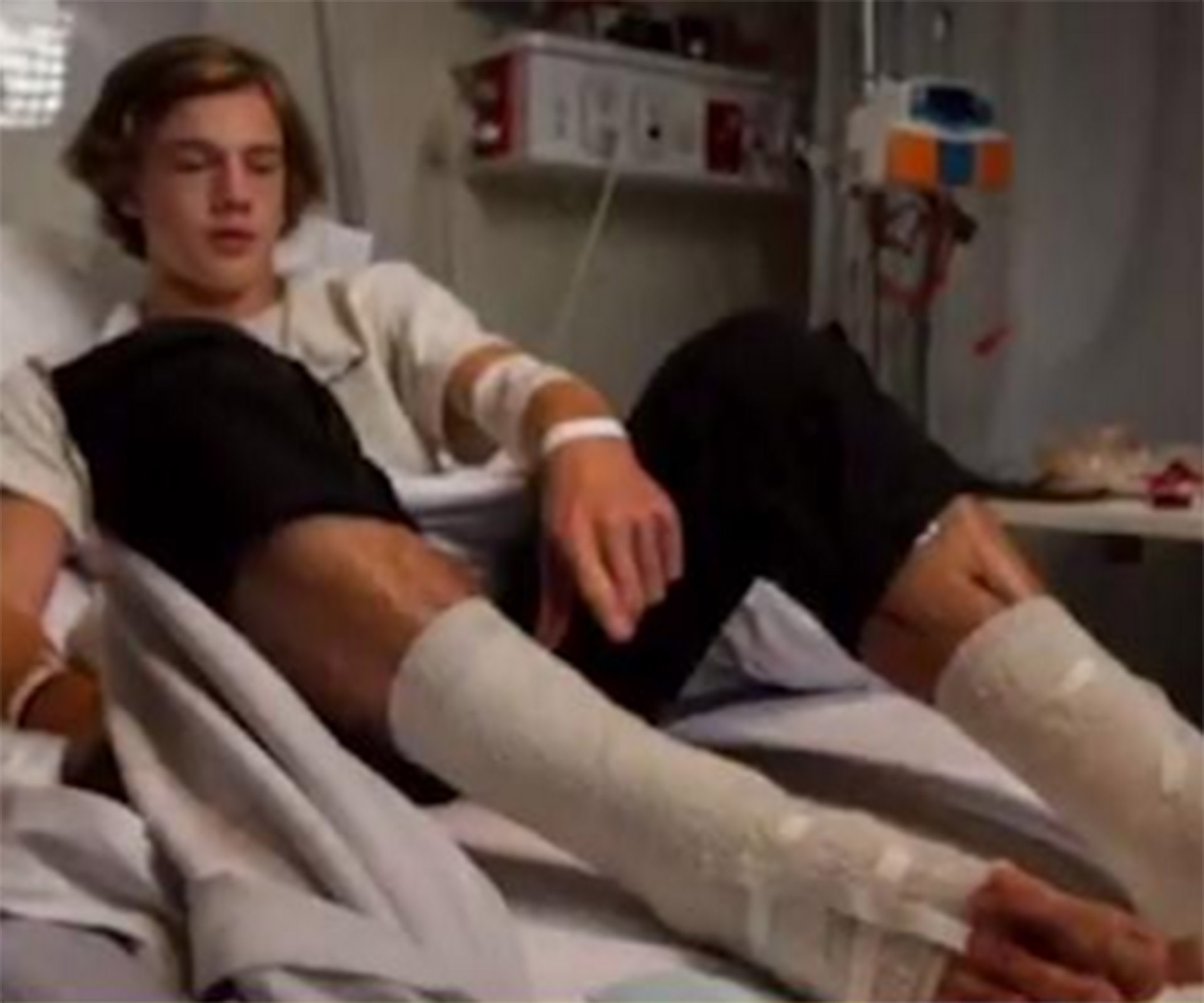 Melbourne teen ‘eaten’ by mystery sea creatures after going for a quick dip after footie