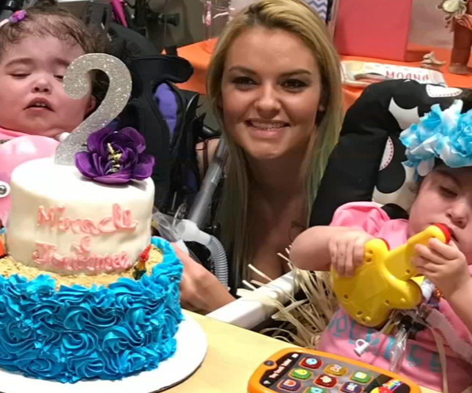 Formerly conjoined twins beat the odds, but two years after separating they’re living ‘day by day’