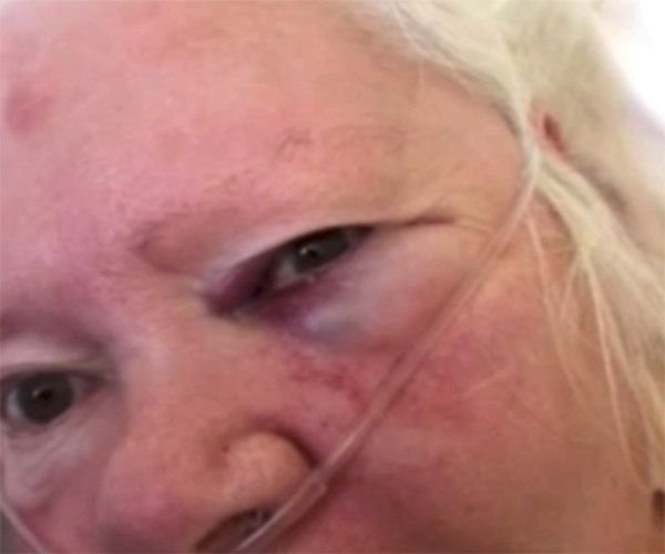 Nurse accused of hitting woman with a mug of Milo