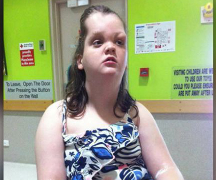 Queensland teenager’s rare condition threatens to close her airways