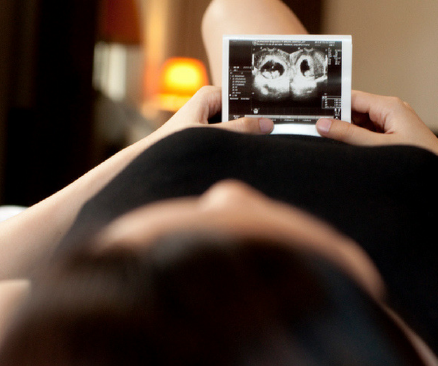 Woman on bed holding ultrasound image