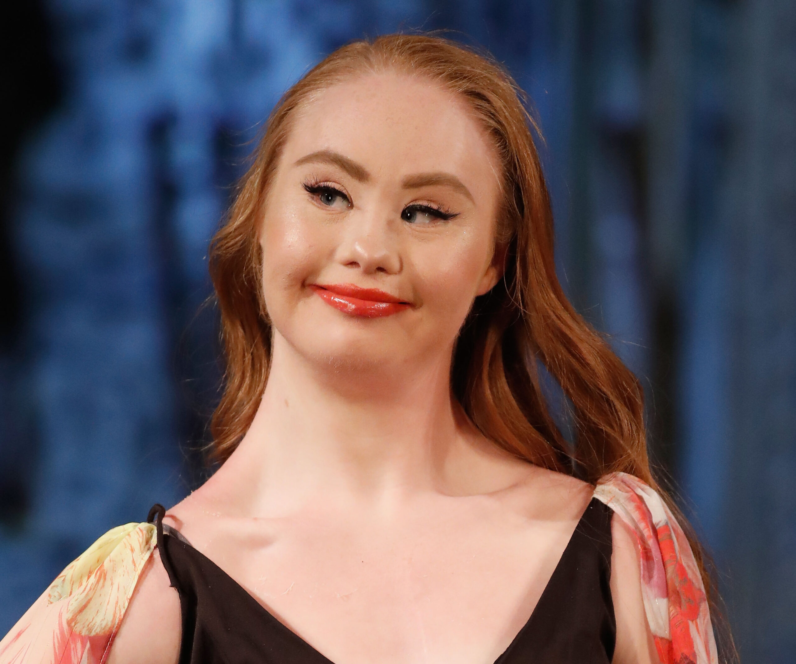 EXCLUSIVE: The inspirational story of model Madeline Stuart will blow your mind