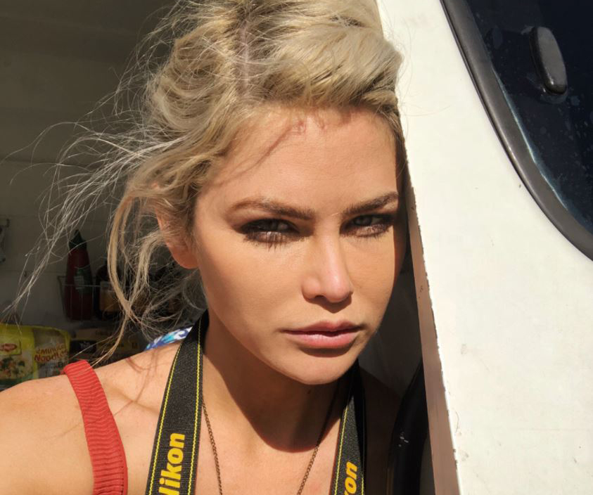 Bachelor In Paradise star Megan Marx’s serious warning about cosmetic surgery after botched job