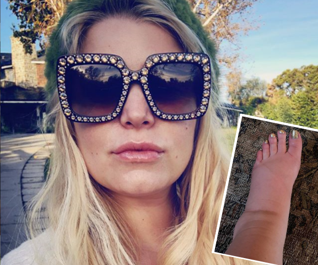 Jessica Simpson turns to the internet for help with her pregnancy swelling