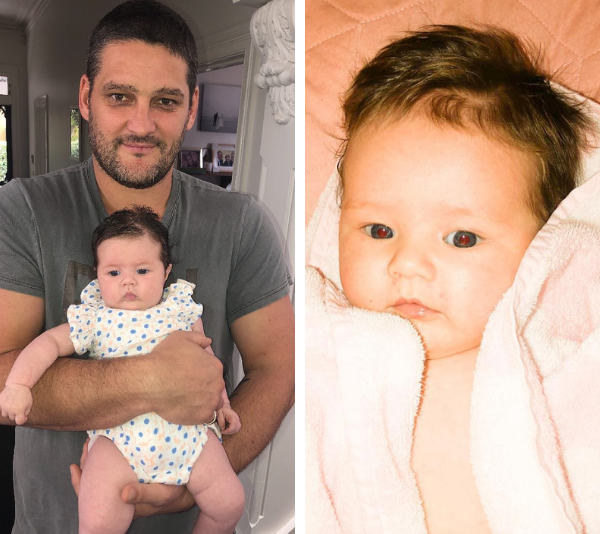 Brendan and Alex Fevola give a positive update on baby Tobi’s health scare