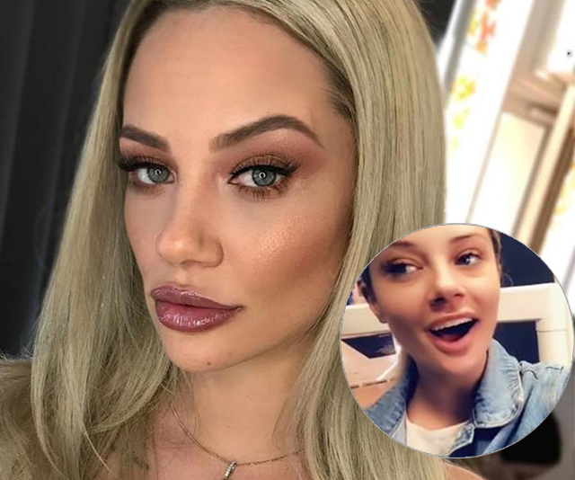 Shock MAFS surgery: Jessika just revealed she’s had her lip fillers REMOVED