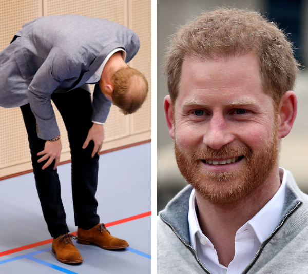 Seriously, poor Prince Harry’s bald patch keeps getting bigger and bigger