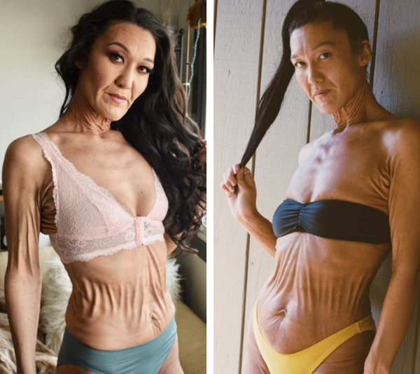 The SHOCKING condition that keeps this body positive model bed bound and unable to eat