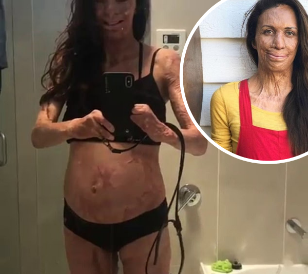 Celebrities inundate Turia Pitt’s Instagram with well wishes after she announces second pregnancy