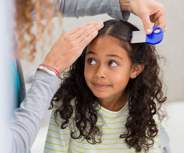 How to treat the new breed of ‘super’ head lice