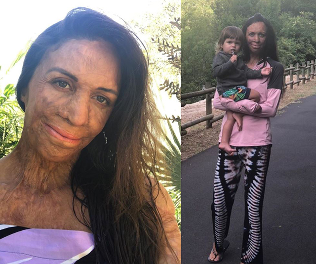 Turia Pitt speaks candidly about enjoying the “small moments” rather than milestones with her son