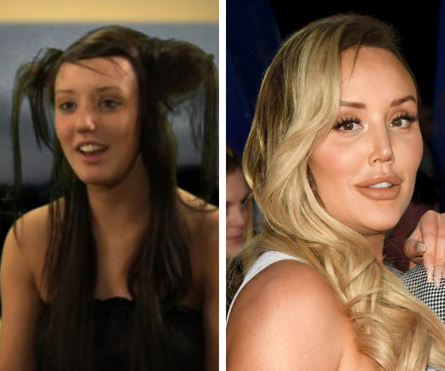 Charlotte Crosby’s plastic surgery transformation in photos