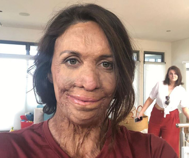 Turia Pitt shares her gratitude for the support of her bushfire campaign Spend With Them