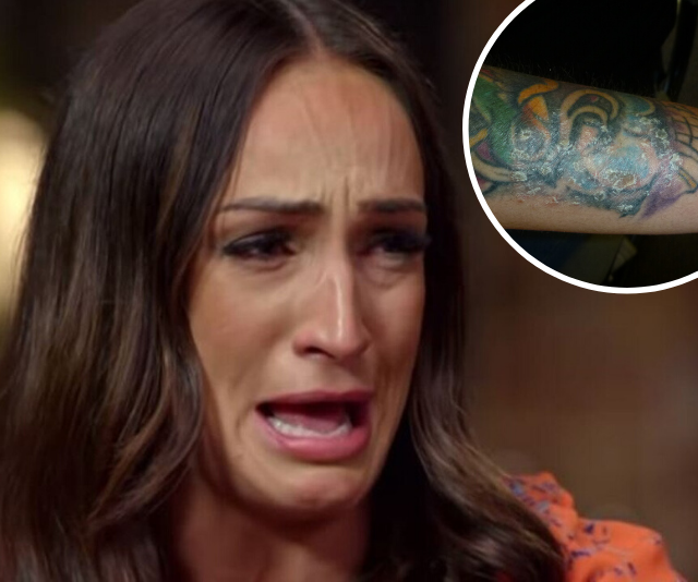 EXCLUSIVE PHOTOS: MAFS star Hayley Vernon reveals the horrifying skin condition that plagued her life for years